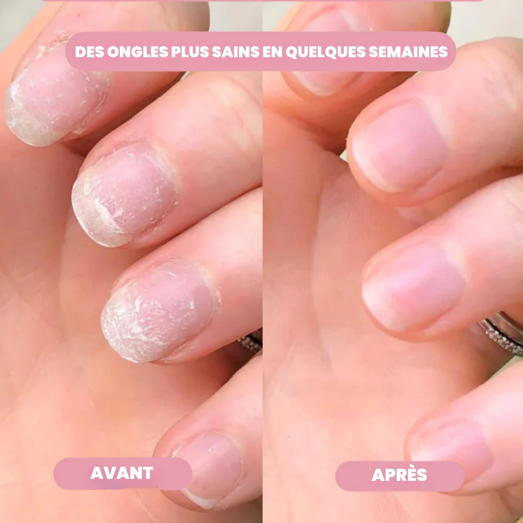 Stylo Soin Précieux